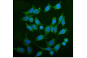 IF analysis of AS160/TBC1D4 using anti-AS160/TBC1D4 antibody (ABIN7599745). (TBC1D4 抗体  (AA 1118-1298))