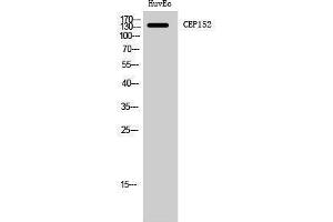 Western Blotting (WB) image for anti-Centrosomal Protein 152kDa (CEP152) (Internal Region) antibody (ABIN3174341) (CEP152 抗体  (Internal Region))