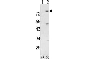 Western Blotting (WB) image for anti-Phosphoinositide-3-Kinase, Regulatory Subunit 5 (PIK3R5) antibody (ABIN3003638) (PIK3R5 抗体)