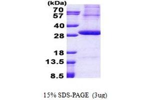 SDS-PAGE (SDS) image for Kallikrein 2 (KLK2) (AA 25-261) protein (His tag) (ABIN5853050) (Kallikrein 2 Protein (KLK2) (AA 25-261) (His tag))