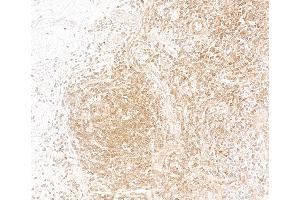 Immunohistochemistry (IHC) image for anti-Nuclear Factor of kappa Light Polypeptide Gene Enhancer in B-Cells 1 (NFKB1) (AA 1-50) antibody (ABIN7795779)