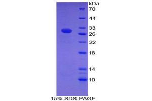 SDS-PAGE analysis of Mouse Intercellular Adhesion Molecule 2 Protein. (ICAM2 蛋白)