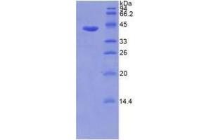 SDS-PAGE analysis of Human Matrix Metalloproteinase 8 (MMP8) Protein. (MMP8 蛋白)