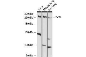 Western blot analysis of extracts of various cell lines, using EVPL antibody (ABIN6129811, ABIN6140350, ABIN6140351 and ABIN6214378) at 1:1000 dilution. (Envoplakin 抗体  (AA 1784-2033))