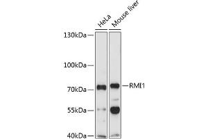 Western blot analysis of extracts of various cell lines, using RMI1 Antibody (ABIN1682540, ABIN3019316, ABIN3019317, ABIN5664937 and ABIN6220821) at 1:1000 dilution. (RMI1 抗体  (AA 1-350))