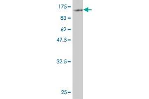 Western Blot detection against Immunogen (88. (ZYX 抗体  (AA 1-572))
