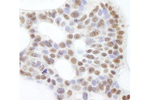 Immunohistochemistry (IHC) image for anti-Ubiquitin Specific Peptidase 47 (USP47) (C-Term) antibody (ABIN7449031) (USP47 抗体  (C-Term))
