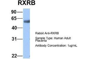 Host:  Rabbit  Target Name:  RXRB  Sample Type:  Human Adult Placenta  Antibody Dilution:  1. (Retinoid X Receptor beta 抗体  (N-Term))
