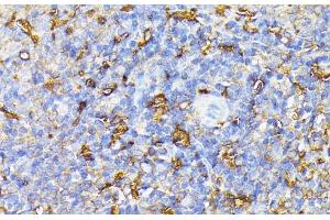 Immunohistochemistry of paraffin-embedded Rat spleen using VEGF Receptor 1 Polyclonal Antibody at dilution of 1:100 (40x lens). (FLT1 抗体)