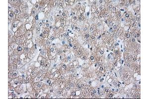 Immunohistochemistry (IHC) image for anti-Heat Shock 70kDa Protein 1A (HSPA1A) antibody (ABIN1498743) (HSP70 1A 抗体)