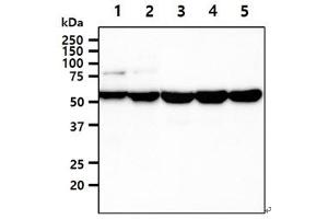 The cell lysates (40ug) were resolved by SDS-PAGE, transferred to PVDF membrane and probed with anti-human UGDH antibody (1:1000). (UGDH 抗体)