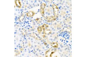 Immunohistochemistry of paraffin-embedded mouse kidney using CST4 antibody at dilution of 1:100 (40x lens). (CST4 抗体)