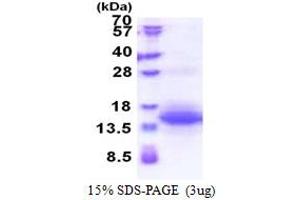 SDS-PAGE (SDS) image for Ubiquinol-Cytochrome C Reductase Hinge Protein (Uqcrh) (AA 14-91) protein (His tag) (ABIN5853412)
