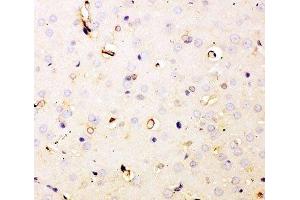 IHC-P staining of rat brain tissue (Dihydrofolate Reductase 抗体  (AA 2-187))