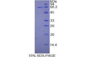 SDS-PAGE analysis of Rat MAP2 Protein. (MAP2 蛋白)