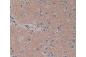IHC-P analysis of brain tissue, with DAB staining. (ITPA 抗体  (AA 3-180))