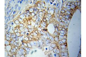 Immunohistochemistry (IHC) image for anti-ATG5 Autophagy Related 5 (ATG5) (AA 1-275) antibody (ABIN3020674) (ATG5 抗体  (AA 1-275))
