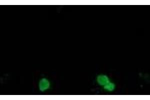 Image no. 1 for anti-Synovial Sarcoma, X Breakpoint 1 (SSX1) antibody (ABIN1501158) (SSX1 抗体)