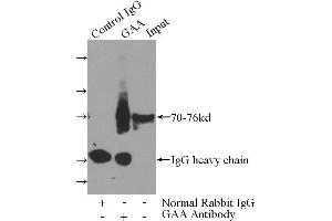 IP analysis of mouse liver tissue lysate (4000 μg), using GAA antibody (4 μg, 1/600 dilution). (GAA 抗体)