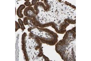 Immunohistochemical staining of human placenta with YIPF2 polyclonal antibody  shows strong cytoplasmic positivity in trophoblastic at 1:50-1:200 dilution. (YIPF2 抗体)