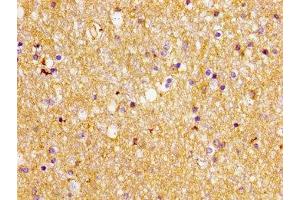 Immunohistochemistry (IHC) image for anti-Solute Carrier Family 1 (Glial High Affinity Glutamate Transporter), Member 2 (SLC1A2) (AA 460-574) antibody (ABIN7152234)