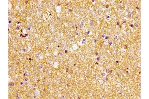 Immunohistochemistry of paraffin-embedded human brain tissue using ABIN7152234 at dilution of 1:100 (SLC1A2 抗体  (AA 460-574))