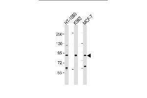 All lanes : Anti-TBK Antibody  at 1:2000 dilution Lane 1: HT-1080 whole cell lysate Lane 2: K562 whole cell lysate Lane 3: MCF-7 whole cell lysate Lysates/proteins at 20 μg per lane. (TBK1 抗体  (AA 150-181))