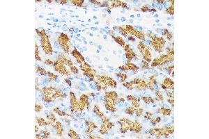Immunohistochemistry of paraffin-embedded mouse pancreas using CTRL Rabbit mAb (ABIN7266395) at dilution of 1:100 (40x lens). (Chymotrypsin 抗体)