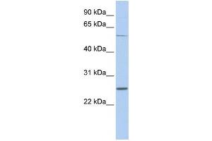 Western Blotting (WB) image for anti-Sodium Channel, Voltage-Gated, Type I, beta (SCN1B) antibody (ABIN2458126) (SCN1B 抗体)