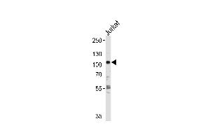 HK2 Antibody  f western blot analysis in Jurkat cell line lysates (35 μg/lane). (Hexokinase 2 抗体  (AA 453-483))