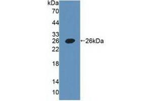 Detection of Recombinant PDPN, Human using Polyclonal Antibody to Podoplanin (PDPN) (Podoplanin 抗体  (AA 23-143))