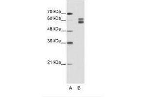 Image no. 1 for anti-Mismatch Repair Protein 2 (MSH2) (AA 151-200) antibody (ABIN203217) (MSH2 抗体  (AA 151-200))