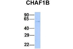 Host:  Rabbit  Target Name:  CHAF1B  Sample Type:  293T  Antibody Dilution:  1.