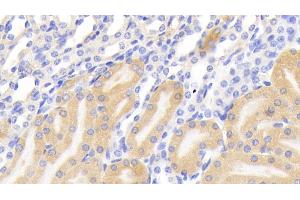 Detection of PIGR in Mouse Kidney Tissue using Polyclonal Antibody to Polymeric Immunoglobulin Receptor (PIGR) (PIGR 抗体  (AA 135-237))