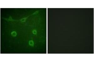 Immunofluorescence analysis of NIH-3T3 cells, using Trk A (Phospho-Tyr496) Antibody. (TRKA 抗体  (pTyr496))