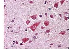 Anti-PPCA Antibody - Immunohistochemistry  Anti-PPCA antibody was diluted 1:500 to detect PPCA in human brain cortex tissue. (CTSA 抗体)