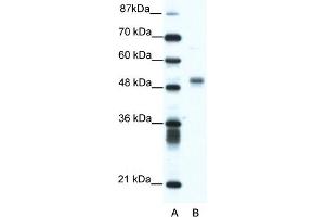 WB Suggested Anti-FLI1 Antibody Titration:  1. (FLI1 抗体  (N-Term))