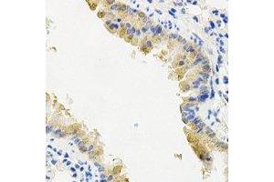 Immunohistochemical analysis of PYGL staining in mouse lung formalin fixed paraffin embedded tissue section. (PYGL 抗体)