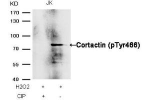 Western blot analysis of extracts from JK cells, treated with H2O2 or calf intestinal phosphatase (CIP), using Cortactin (Phospho-Tyr466) Antibody. (Cortactin 抗体  (pTyr466))