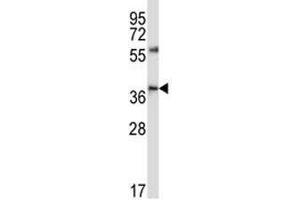 CD33 antibody western blot analysis in NCI-H460 lysate (CD33 抗体  (AA 88-117))