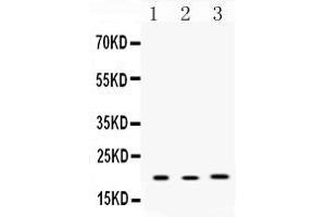 Western blot analysis of Anterior Gradient 2 expression in rat lung extract ( Lane 1), mouse liver extract ( Lane 2) and MCF-7 whole cell lysates ( Lane 3). (AGR2 抗体  (AA 21-175))
