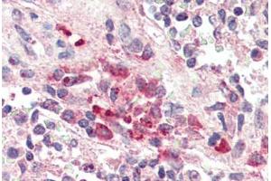 Human Spleen, Macrophages (formalin-fixed, paraffin-embedded) stained with TREM2 antibody ABIN337127 at 2. (TREM2 抗体  (AA 199-212))