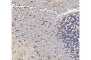Immunohistochemistry analysis of paraffin-embedded mouse brain using,CHERP (ABIN7073277) at dilution of 1: 3600 (CHERP 抗体)