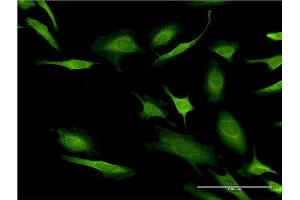 Immunofluorescence of monoclonal antibody to CASP10 on HeLa cell. (Caspase 10 抗体  (AA 19-187))