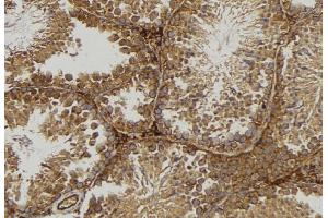 ABIN6277080 at 1/100 staining Mouse testis tissue by IHC-P.