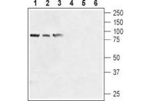 Western blot analysis of human prostate carcinoma cell lines (LNCaP (lanes 1 and 4), DU145 (lanes 2 and 5), PC-3 (lanes 3 and 6) lysates: - 1-3. (TRPV6 抗体  (1st Extracellular Loop))