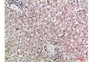 Immunohistochemistry (IHC) image for anti-Melanoma Inhibitory Activity Protein 2 (MIA2) (AA 361-410) antibody (ABIN7184396)