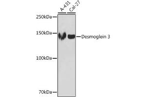 Western blot analysis of extracts of various cell lines, using Desmoglein 3 Rabbit mAb (ABIN7266741) at 1:1000 dilution. (Desmoglein 3 抗体)