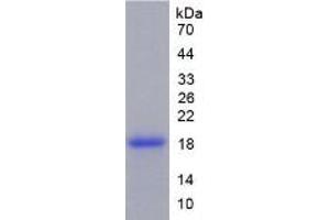 SDS-PAGE of Protein Standard from the Kit  (Highly purified E. (TNC ELISA 试剂盒)