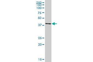 FECH MaxPab polyclonal antibody. (FECH 抗体  (AA 1-423))